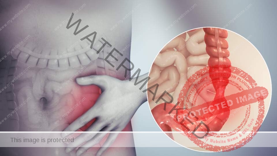 القولون العصبي والإطعمة التى يجب تجنبها للوقاية من مضاعفاته