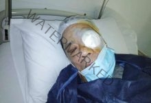 حلمي بكر يخضع لعملية جراحية في عينه داخل إحدى مستشفيات القاهرة