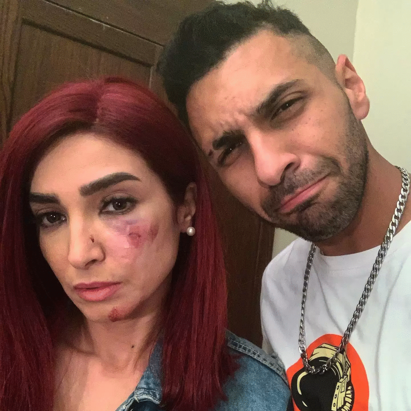 إصابة الفنانة روجينا  بـ7 غرز فى وجهها خلال تصوير مسلسل بنت السلطان