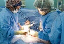 بلاغ ضد طبيب لـ نسيانه فوطة جراحية داخل بطن سيدة بعد عملية ولاده قيصرية