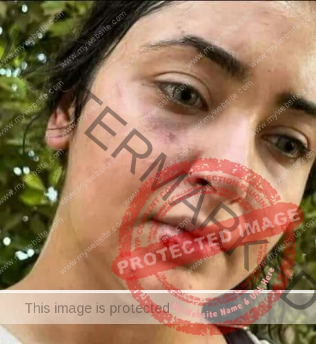 الاعتداء بالضرب على الدكتورة "ايزيس" وتعرضها للتحرش بسبب عدم ارتدائها الحجاب