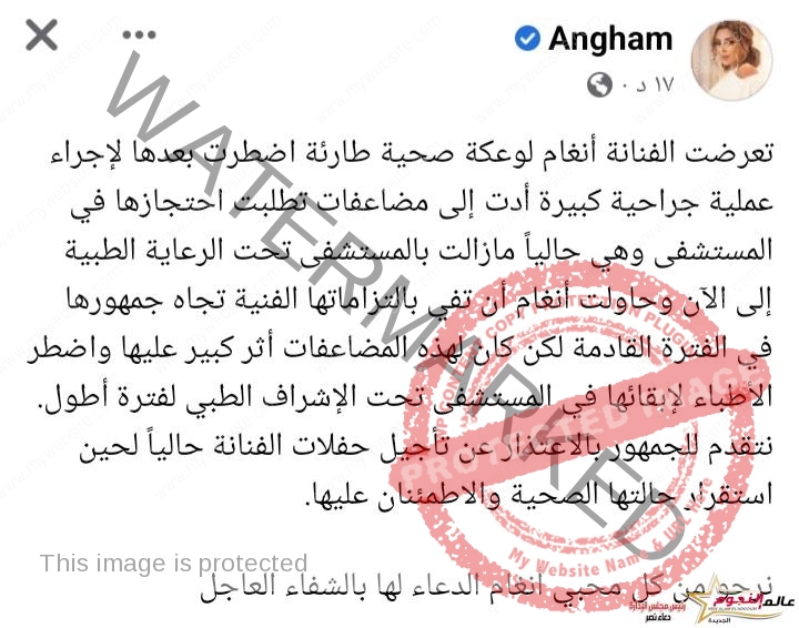 أنغام تعتذر لجمهورها عن تأجيل حفلاتها بسبب تعرضها لوعكة صحية