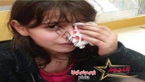 إصابة طفلة إثر انفجار صاروخ ألعاب نارية في عينها بالفيوم