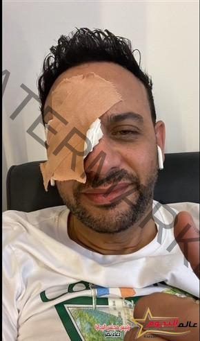 بوكس بالخطأ من خالد سرحان يسبب إصابة مصطفي قمر في عينه