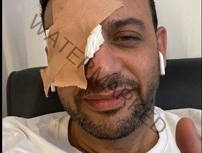 إصابة مصطفى قمر في عينه مما يتسبب في تأجيل تصوير فيلم حريم كريم