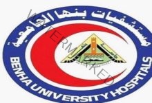 مستشفى بنها الجامعي تنفي تسجيل أول حالة لجدري القرود