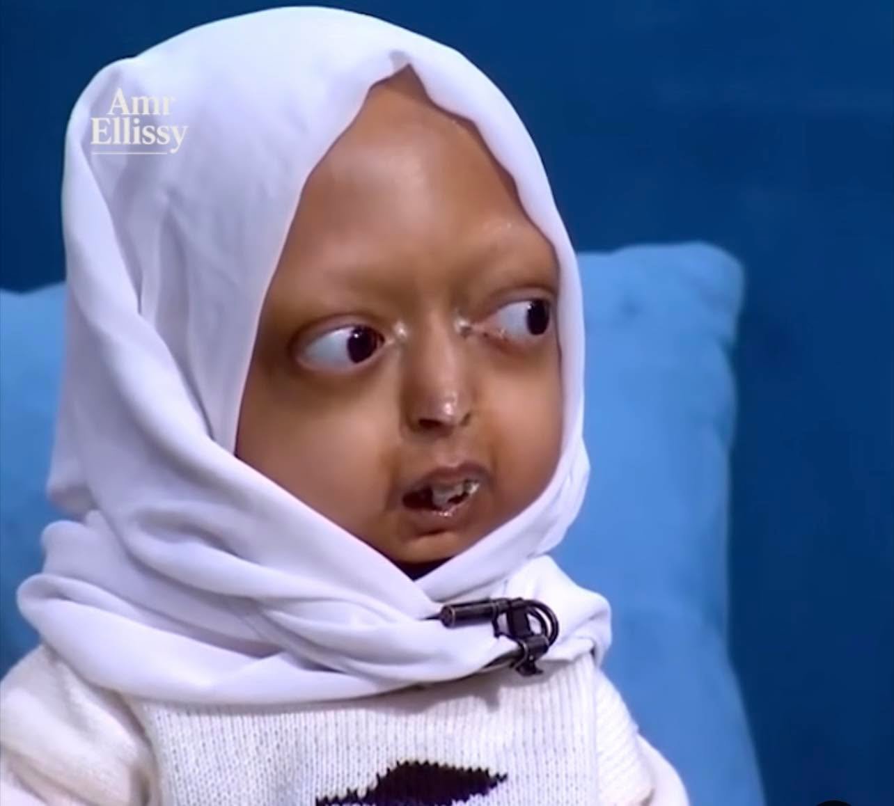 طفلة الشيخوخة المبكرة آلاء تخطف الأنظار في «واحد من الناس».. قصة مؤثرة تهز مشاعر الملايين