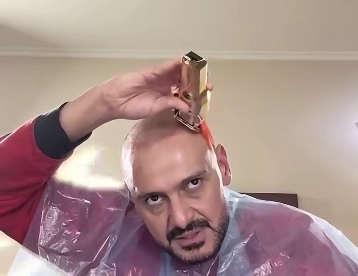 رامز جلال يفاجئ جمهوره بحلاقة شعره «زيرو»: «ارجع لقرعتك» 4 رامز جلال يفاجئ جمهوره بحلاقة شعره «زيرو»: «ارجع لقرعتك»